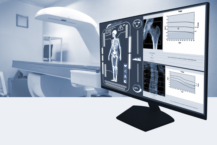 Bone scan illustration