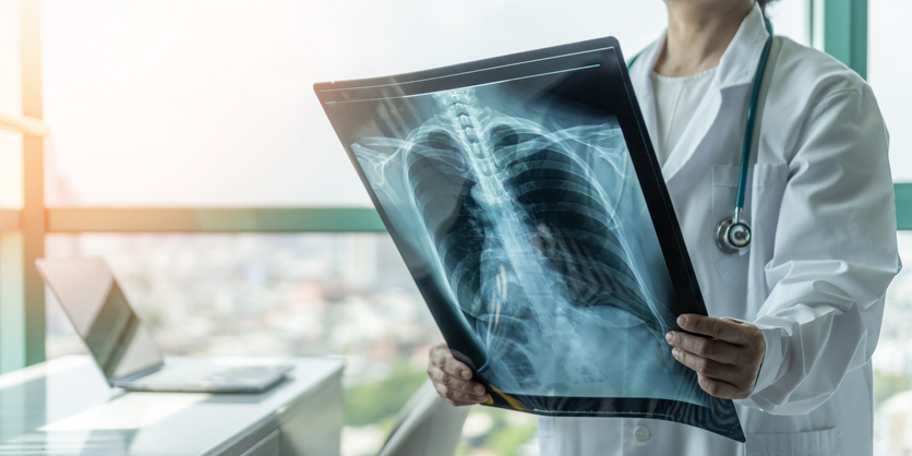 Chest X-ray example