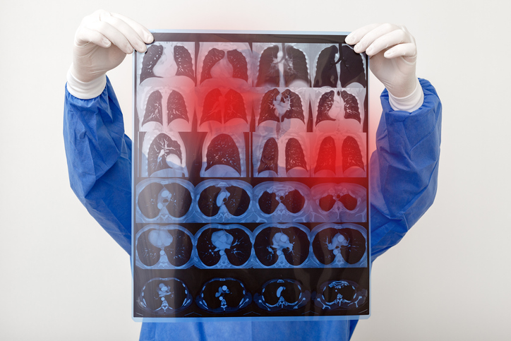 MRI scan example