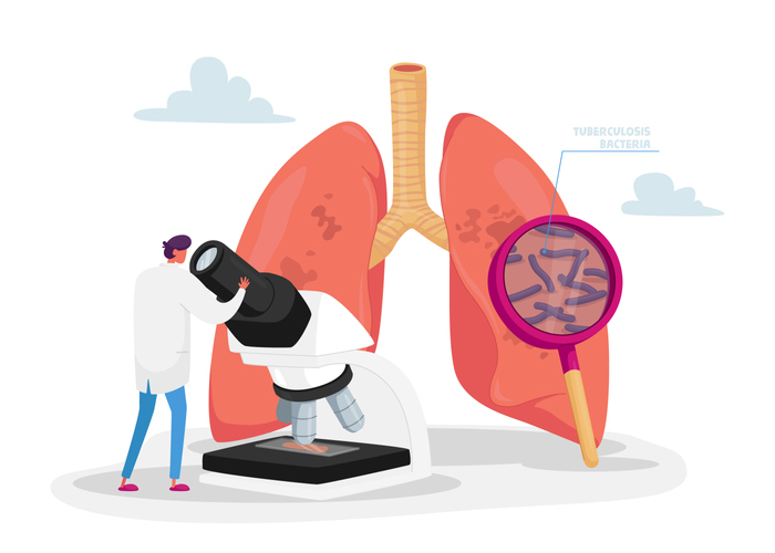Sputum examination illustration