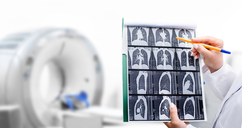 CT scan example